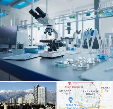 آزمایشگاه زگیل تناسلی در شهرک غرب 