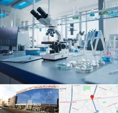 آزمایشگاه زگیل تناسلی در نصف راه تبریز