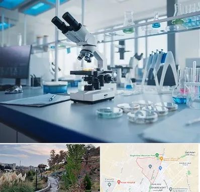 آزمایشگاه زگیل تناسلی در باغستان کرج