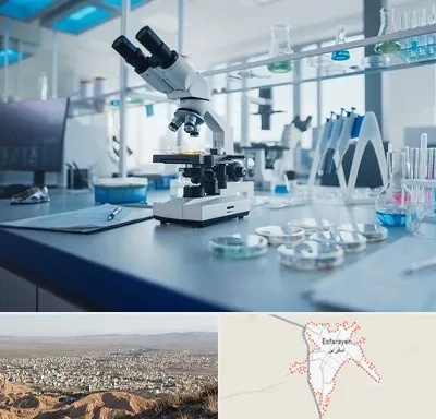 آزمایشگاه زگیل تناسلی در اسفراین