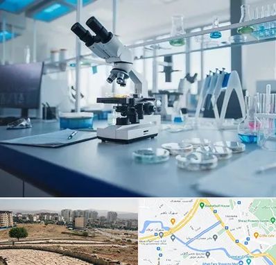 آزمایشگاه زگیل تناسلی در کوی وحدت شیراز