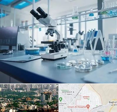 آزمایشگاه زگیل تناسلی در عظیمیه کرج 