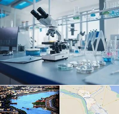 آزمایشگاه زگیل تناسلی در خرمشهر