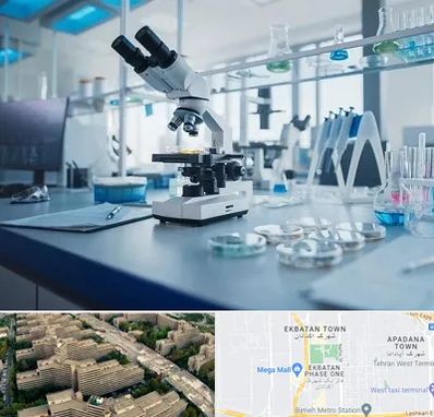 آزمایشگاه زگیل تناسلی در اکباتان 