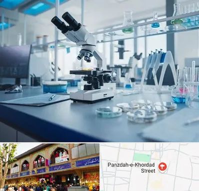 آزمایشگاه زگیل تناسلی در 15 خرداد