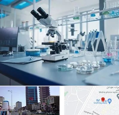آزمایشگاه زگیل تناسلی در چهارراه طالقانی کرج