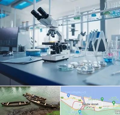 آزمایشگاه زگیل تناسلی در بندر انزلی