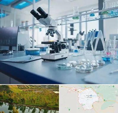 آزمایشگاه زگیل تناسلی در بهبهان