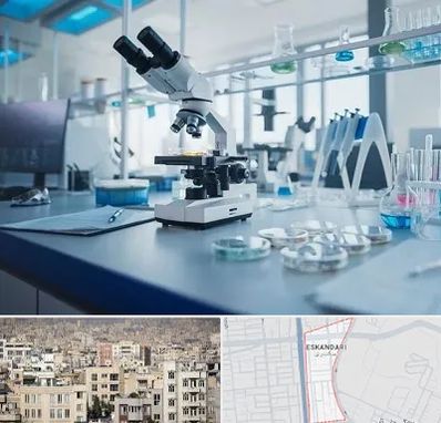 آزمایشگاه زگیل تناسلی در اسکندری