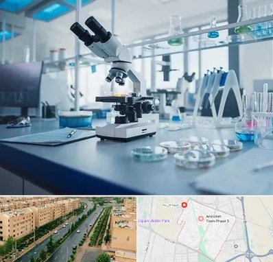 آزمایشگاه زگیل تناسلی در فاز سه اندیشه