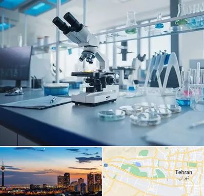 آزمایشگاه زگیل تناسلی در غرب تهران 