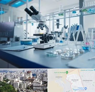 آزمایشگاه زگیل تناسلی در ولنجک 