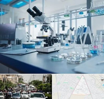 آزمایشگاه زگیل تناسلی در سیدی مشهد