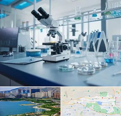 آزمایشگاه زگیل تناسلی در منطقه 22 تهران 