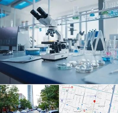 آزمایشگاه زگیل تناسلی در امامت مشهد