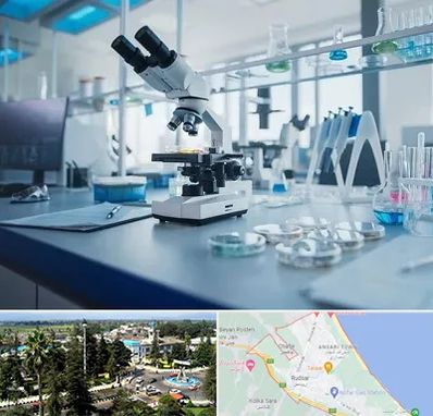 آزمایشگاه زگیل تناسلی در رودسر