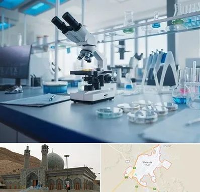 آزمایشگاه زگیل تناسلی در شهرضا