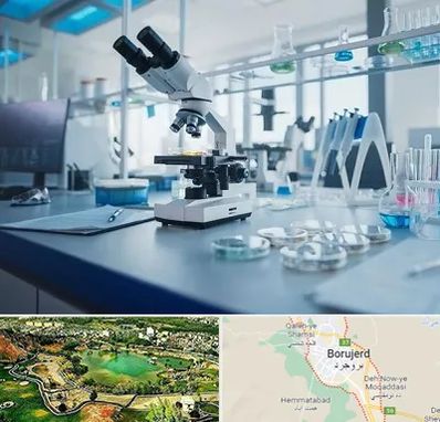 آزمایشگاه زگیل تناسلی در بروجرد