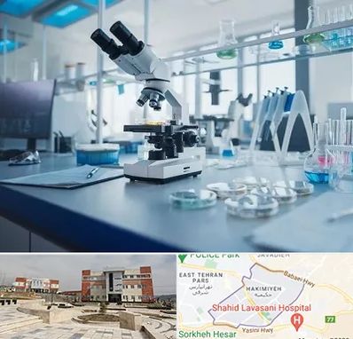 آزمایشگاه زگیل تناسلی در حکیمیه 