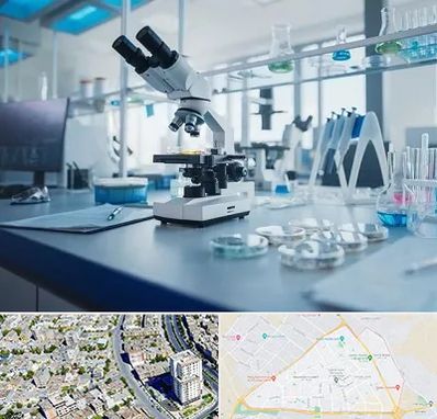 آزمایشگاه زگیل تناسلی در قاسم آباد مشهد