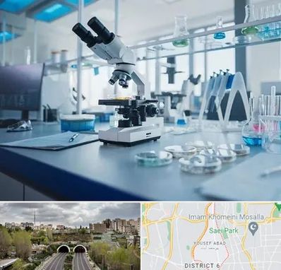 آزمایشگاه زگیل تناسلی در یوسف آباد 