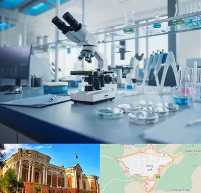 آزمایشگاه زگیل تناسلی در خوی