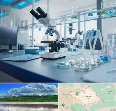 آزمایشگاه زگیل تناسلی در مرند