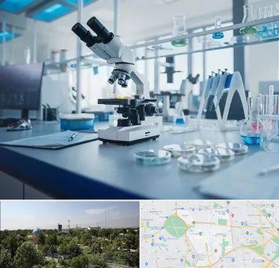 آزمایشگاه زگیل تناسلی در منطقه 16 تهران 