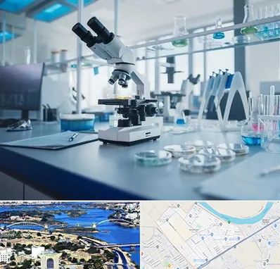 آزمایشگاه زگیل تناسلی در کوروش اهواز