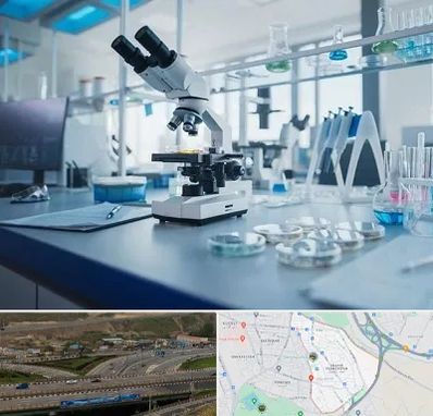 آزمایشگاه زگیل تناسلی در یاغچیان تبریز