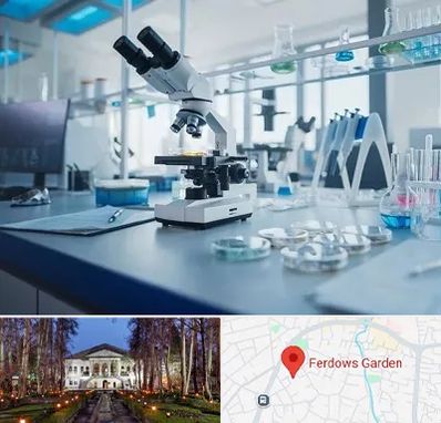 آزمایشگاه زگیل تناسلی در باغ فردوس