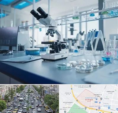 آزمایشگاه زگیل تناسلی در گلشهر کرج