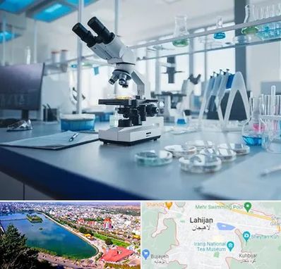 آزمایشگاه زگیل تناسلی در لاهیجان