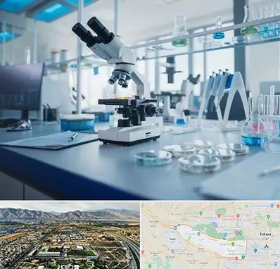 آزمایشگاه زگیل تناسلی در منطقه 21 تهران 