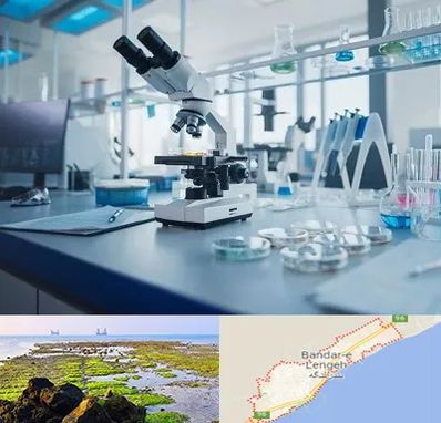 آزمایشگاه زگیل تناسلی در بندرلنگه