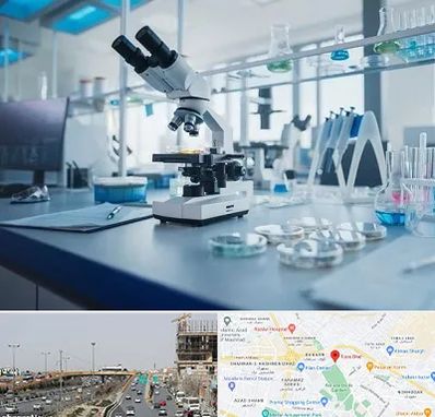 آزمایشگاه زگیل تناسلی در بلوار توس مشهد