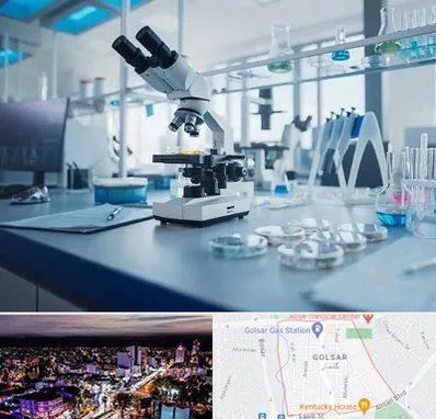 آزمایشگاه زگیل تناسلی در گلسار رشت 