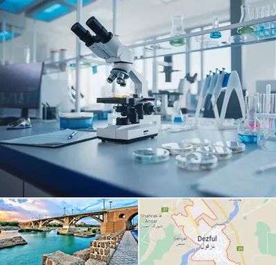 آزمایشگاه زگیل تناسلی در دزفول