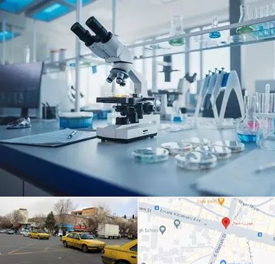 آزمایشگاه زگیل تناسلی در شهناز تبریز