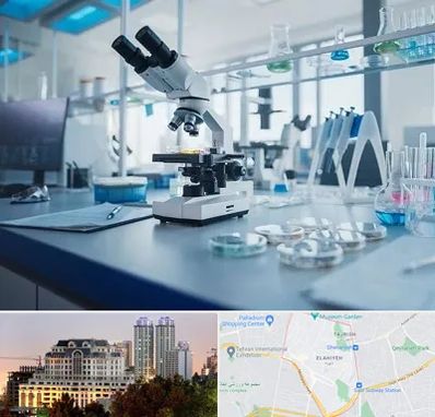 آزمایشگاه زگیل تناسلی در فرشته 