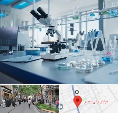 آزمایشگاه زگیل تناسلی در ولیعصر شهریار