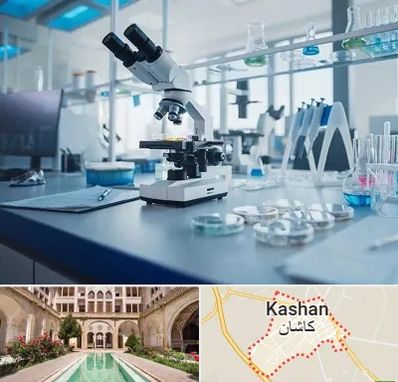 آزمایشگاه زگیل تناسلی در کاشان