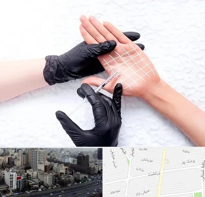 تزریق بوتاکس کف دست در زرتشت