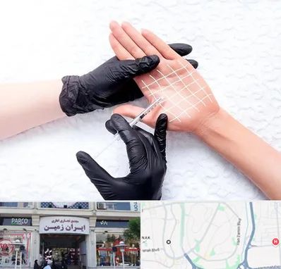 تزریق بوتاکس کف دست در ایران زمین