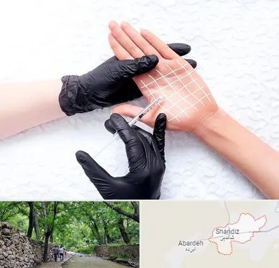 تزریق بوتاکس کف دست در شاندیز مشهد