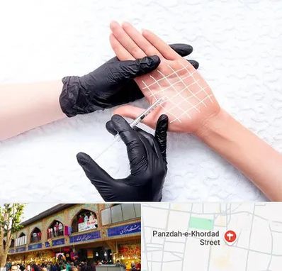 تزریق بوتاکس کف دست در 15 خرداد