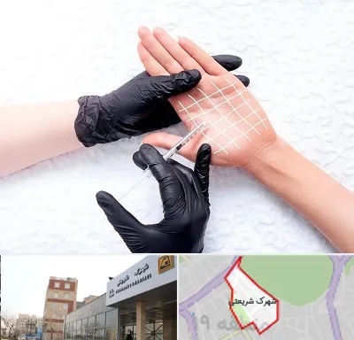 تزریق بوتاکس کف دست در شهرک شریعتی
