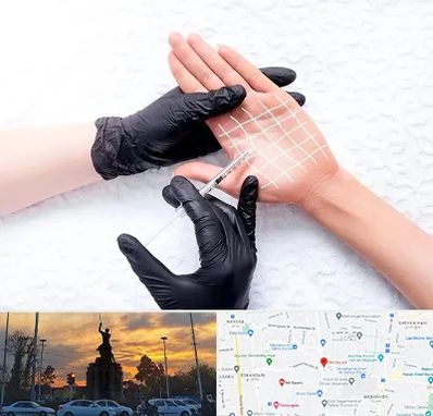 تزریق بوتاکس کف دست در میدان حر 