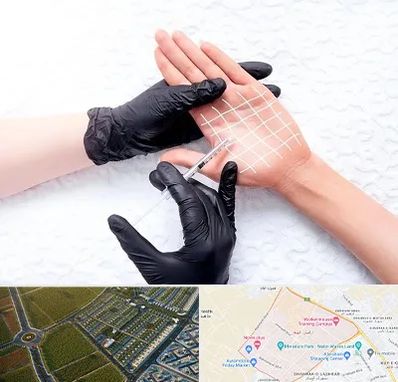 تزریق بوتاکس کف دست در الهیه مشهد