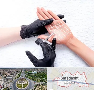 تزریق بوتاکس کف دست در صفادشت